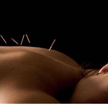 /Acupuncture%20Clinic